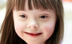 Devojcica sa Daunovim sindromom